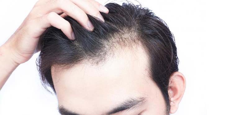 Best Hair PRP Treatment in Viman Nagar Pune